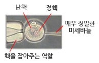 미세주입법 설명이미지 : 핵을 잡아주는 역할의 물체로 난핵, 정핵을 고정하 매우 정밀한 미세바늘로 주입