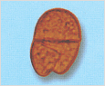 Gyrodinium sp. 이미지