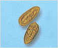 Prorocentrum dentatum 이미지