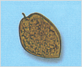 Prorocentrum micans 이미지